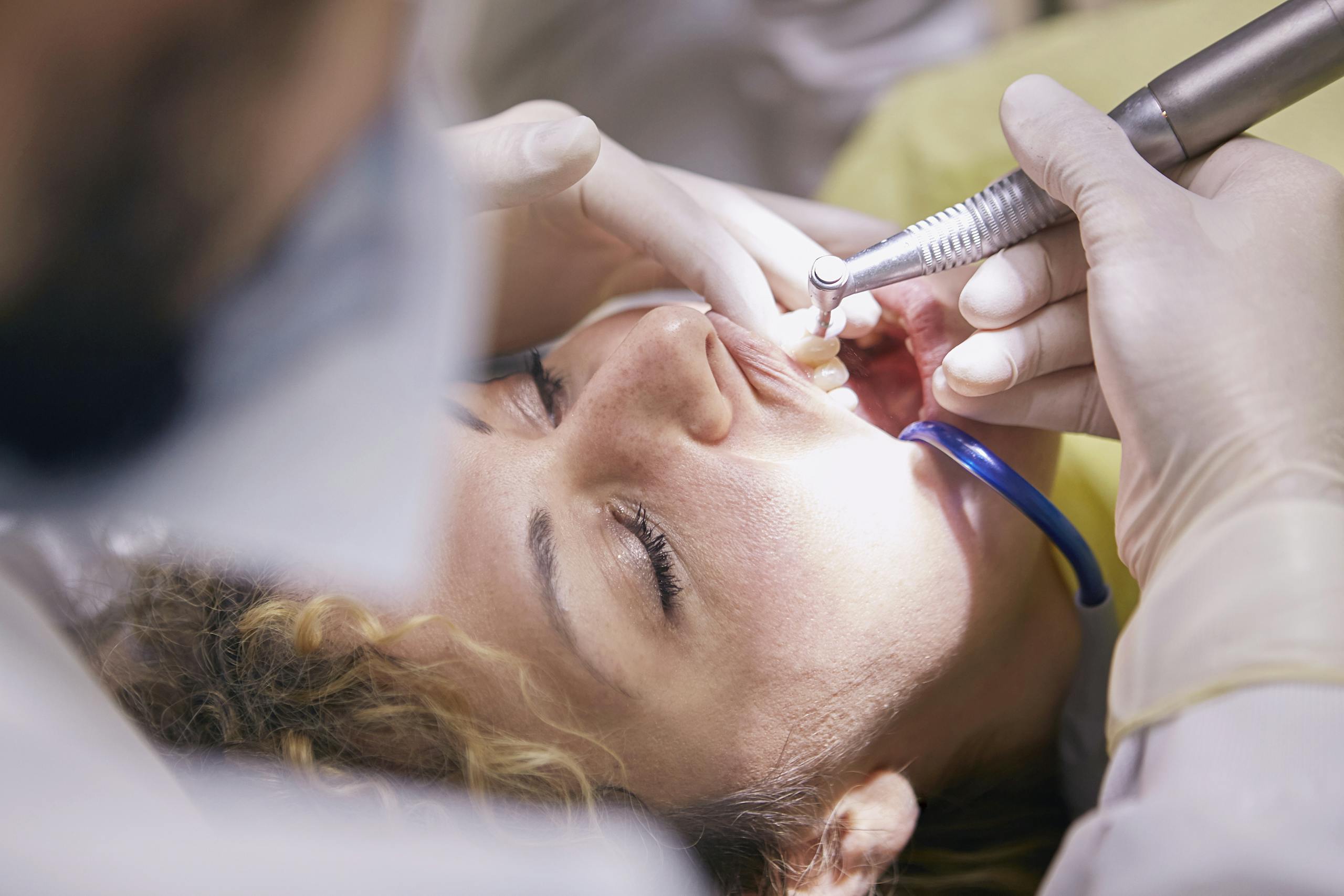 Close-up of a dental procedure with dentist and patient in a clinic setting.